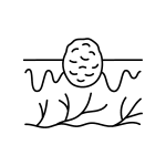 A simple line drawing of a lump or nodule on the surface of skin, with wavy lines underneath representing tissue or inflammation, and branches below indicating blood vessels—illustrating concerns often addressed in wellness and anti-aging care at the Institute For Ageless Living.