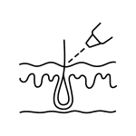 Line drawing of a hair follicle under skin with a laser device targeting it, representing a laser hair removal procedure at the Institute For Ageless Living—a place dedicated to wellness and anti-aging solutions.