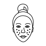 Line drawing of a woman's face with a bun hairstyle, showing dark spots or dots on both cheeks, possibly indicating acne, freckles, or a skin condition—representing wellness concerns often addressed at the Institute For Ageless Living.