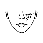 Minimalist line drawing of a face with a branching vein or scar-like line on the right cheek, likely representing a skin condition or facial feature, capturing the essence of wellness and self-acceptance promoted by the Institute For Ageless Living.