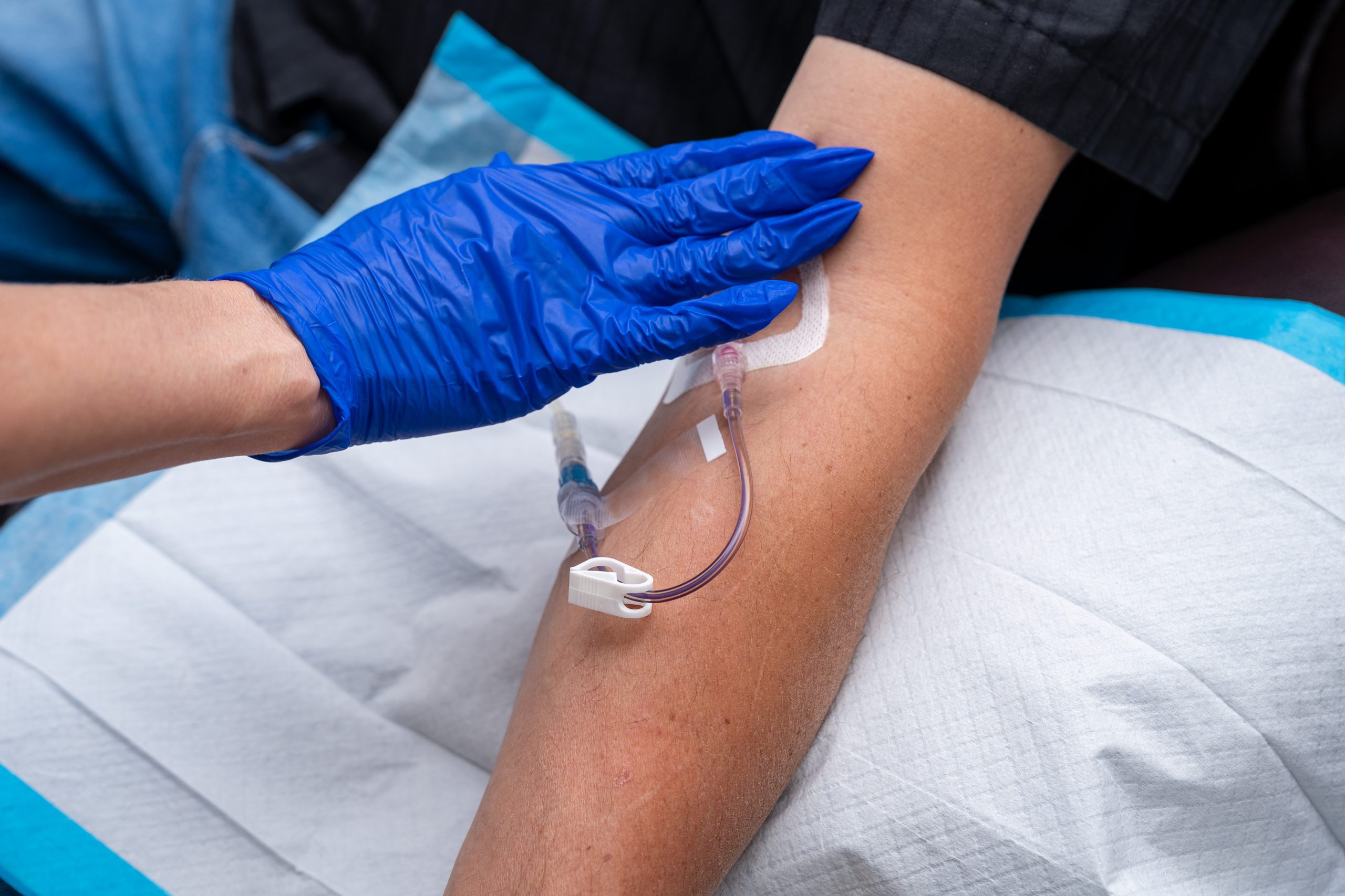 A person's arm with an IV catheter inserted, secured with tape. A gloved hand is gently touching the area, and a medical pad is underneath the arm for cleanliness—a setting commonly seen in wellness treatments at the Institute For Ageless Living.