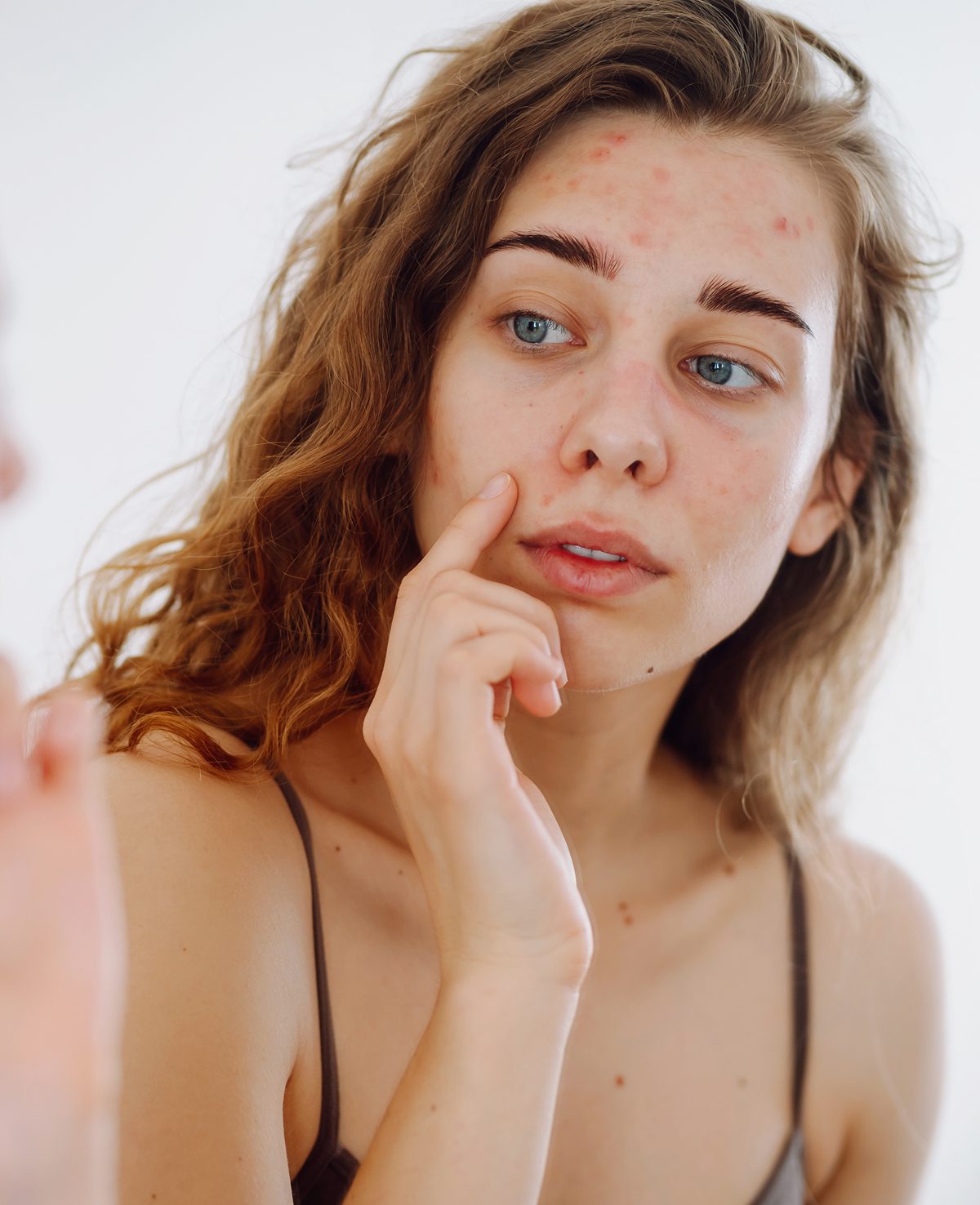 A young woman with long brown hair looks at herself in a mirror, touching her face and examining acne and redness on her forehead and cheeks, as she considers new wellness routines recommended by the Institute For Ageless Living.