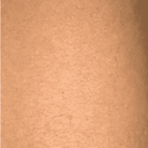 Laser Vein Treatment Before and After - Case laservein, Image 2 - Female, age 55 – 64 - Longmont, CO - Institute for Ageless Living