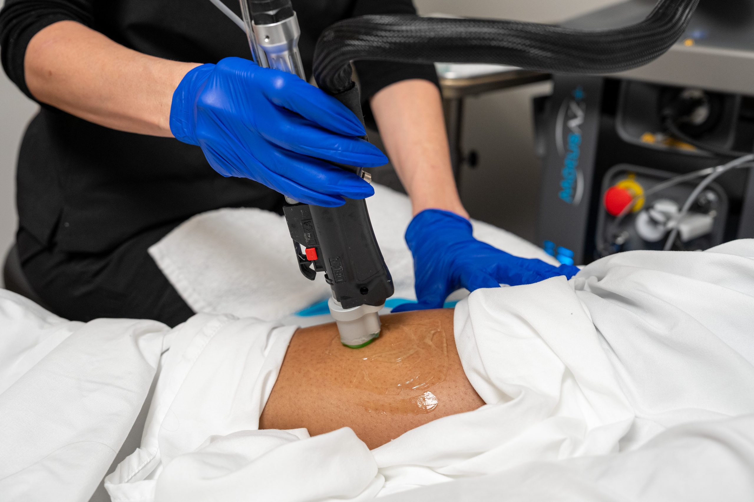 A person wearing blue gloves uses a laser device on a patient's covered leg, likely performing an anti-aging medical or cosmetic procedure in a clinical setting, reflecting the commitment to wellness at the Institute For Ageless Living.