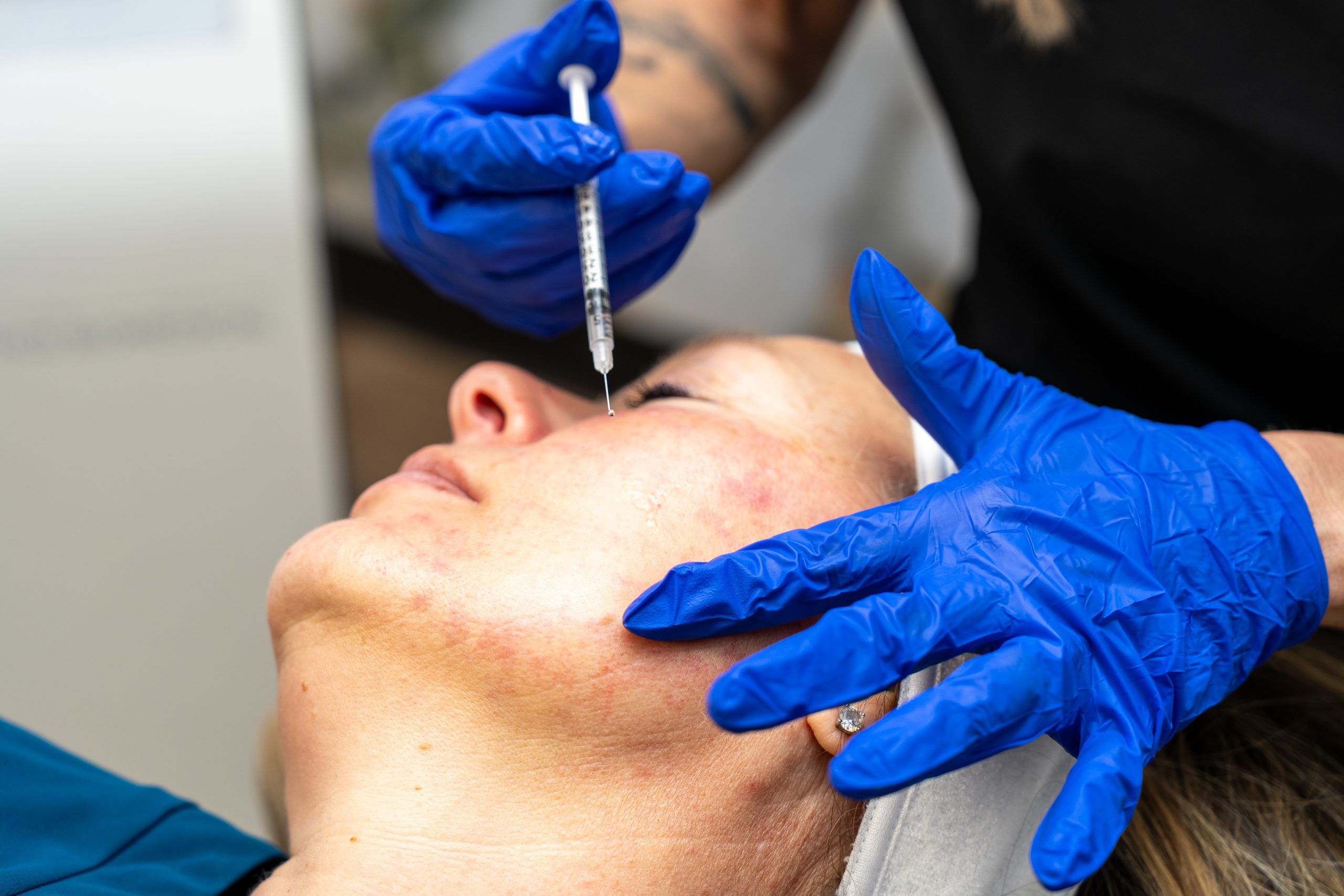 A person wearing blue gloves injects a syringe into the cheek of a woman lying down, possibly during an anti-aging cosmetic procedure at the Institute For Ageless Living.