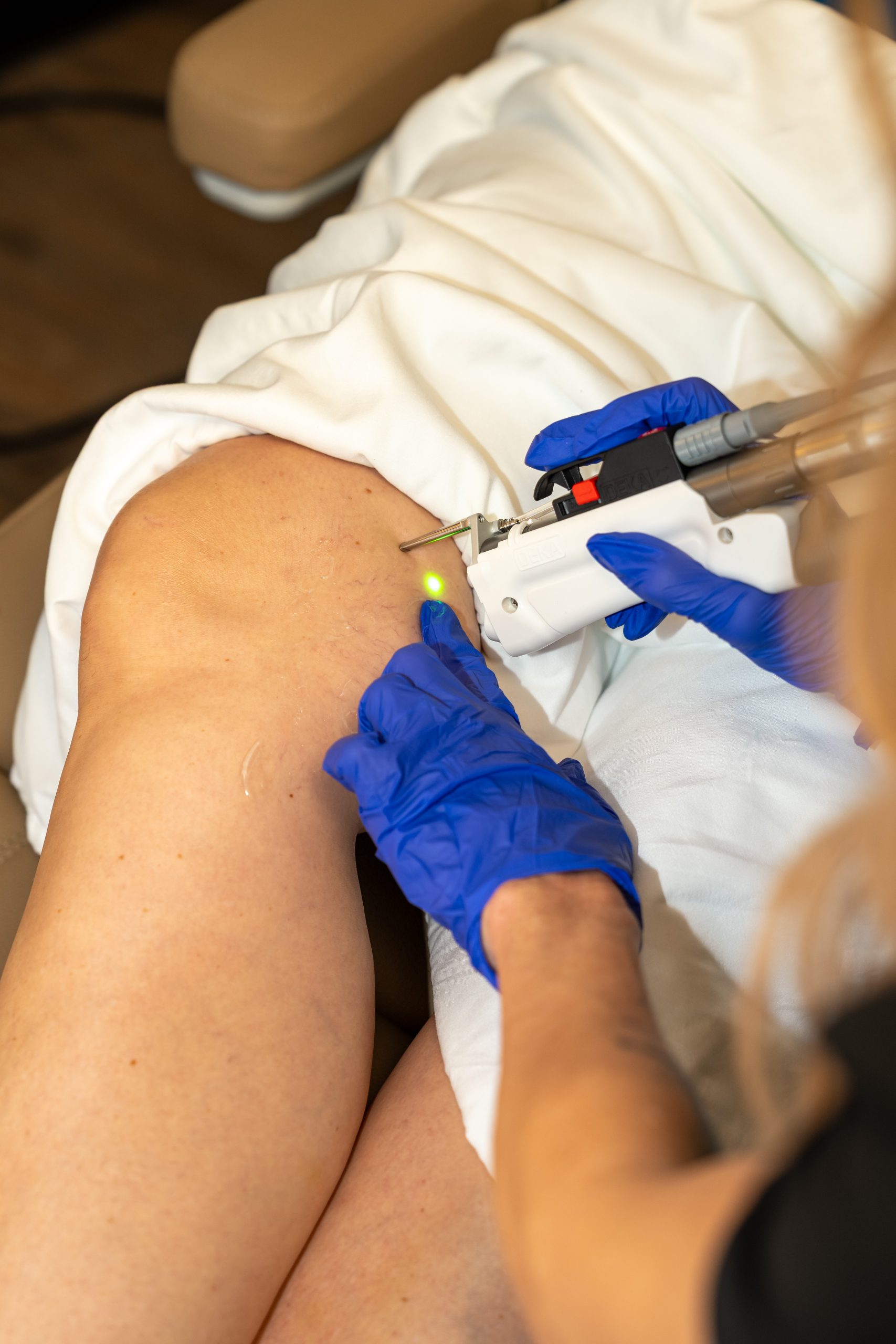 A person wearing blue gloves uses a handheld medical device emitting a green light on a patient's knee, which is partially covered by a white sheet—an innovative approach often utilized at the Institute For Ageless Living to support wellness and anti-aging therapies.