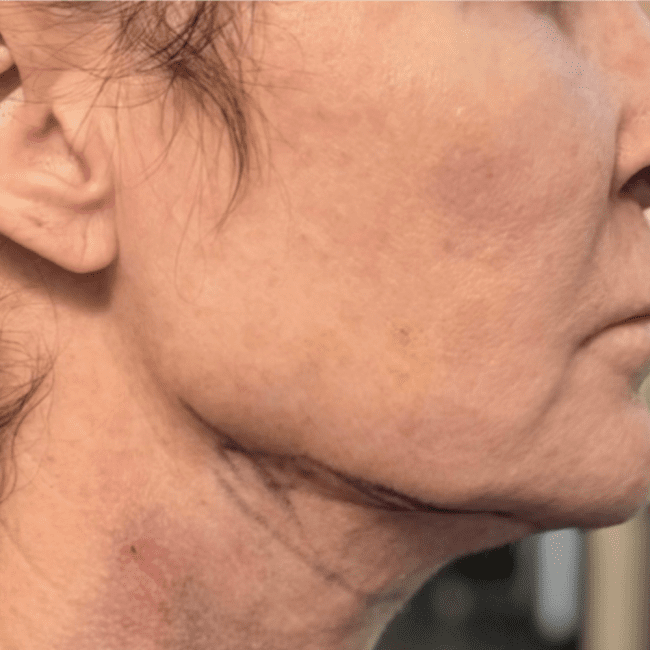 Junera Before & Afters | Institute for Ageless Living