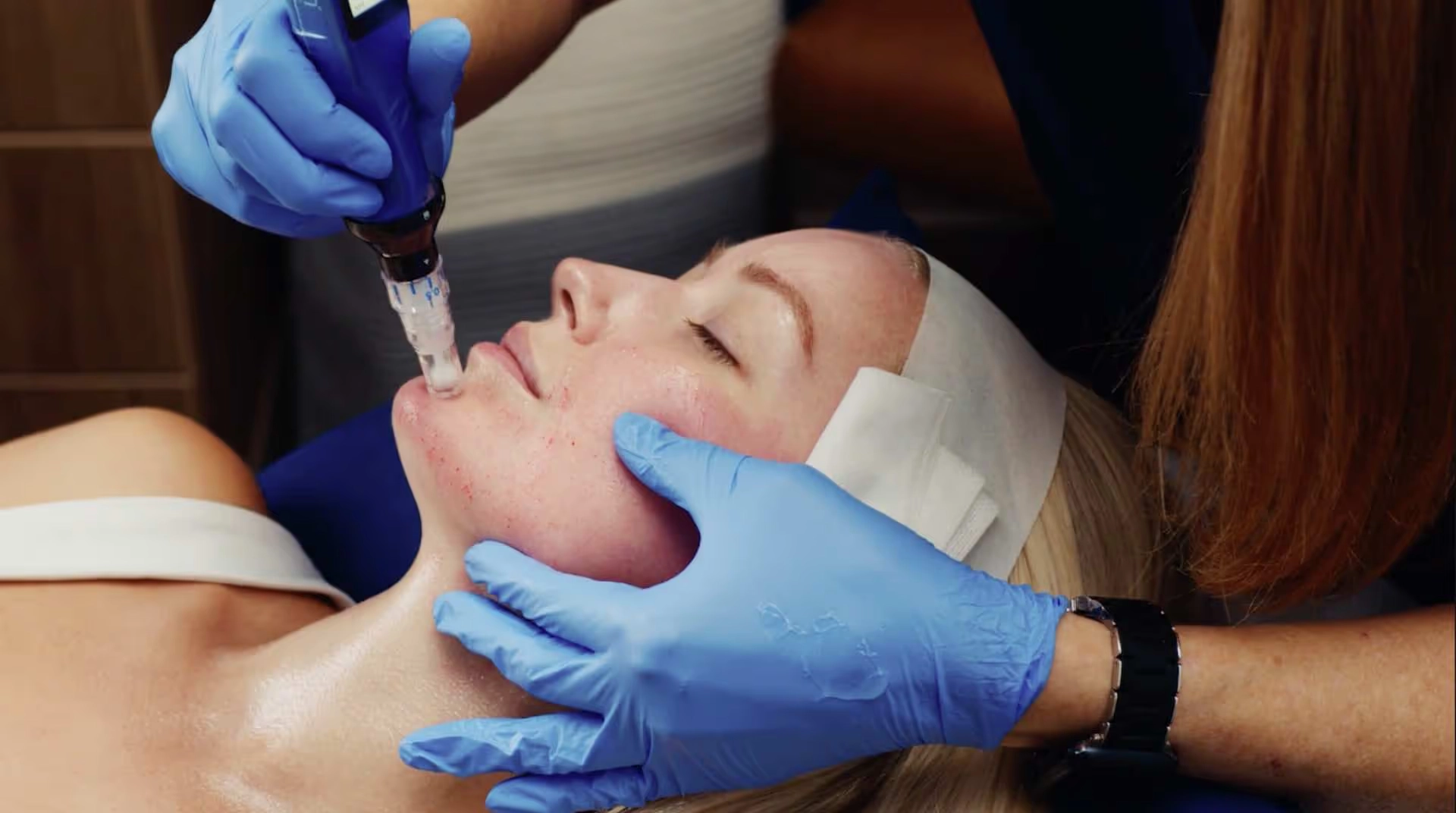 A person with blonde hair receives a microneedling facial treatment from a gloved professional at the Institute For Ageless Living. The patient, embodying wellness and anti-aging care, is lying down with their headbanded and eyes closed.